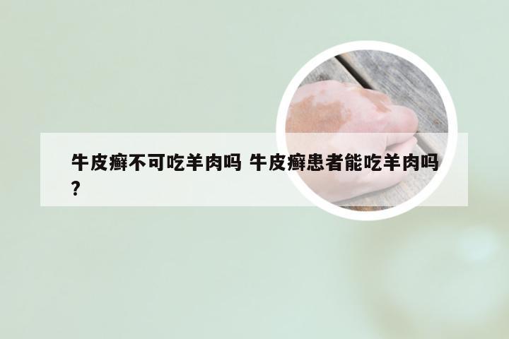 牛皮癣不可吃羊肉吗 牛皮癣患者能吃羊肉吗?