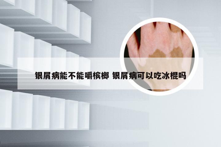 银屑病能不能嚼槟榔 银屑病可以吃冰棍吗