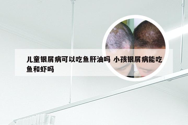 儿童银屑病可以吃鱼肝油吗 小孩银屑病能吃鱼和虾吗