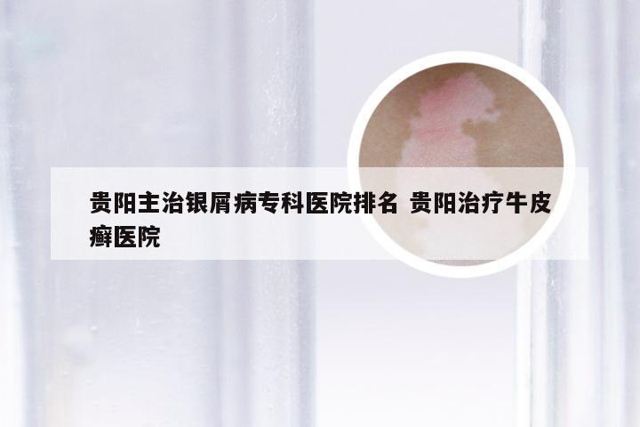 贵阳主治银屑病专科医院排名 贵阳治疗牛皮癣医院