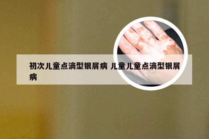 初次儿童点滴型银屑病 儿童儿童点滴型银屑病