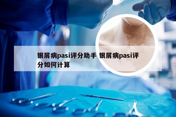 银屑病pasi评分助手 银屑病pasi评分如何计算