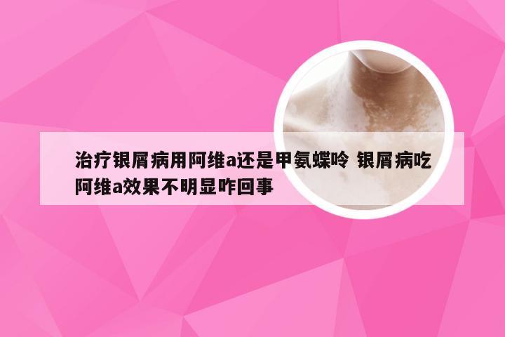治疗银屑病用阿维a还是甲氨蝶呤 银屑病吃阿维a效果不明显咋回事