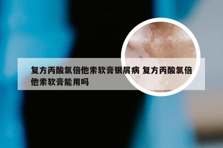 复方丙酸氯倍他索软膏银屑病 复方丙酸氯倍他索软膏能用吗