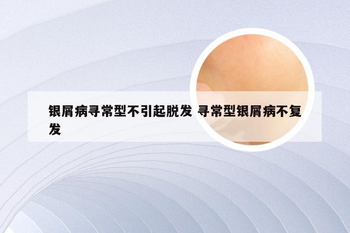 银屑病寻常型不引起脱发 寻常型银屑病不复发