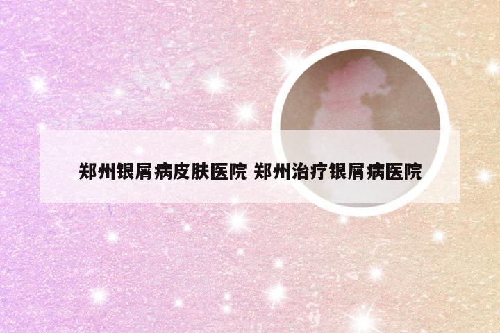 郑州银屑病皮肤医院 郑州治疗银屑病医院