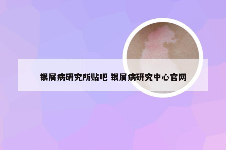 银屑病研究所贴吧 银屑病研究中心官网