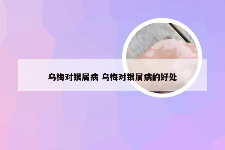乌梅对银屑病 乌梅对银屑病的好处