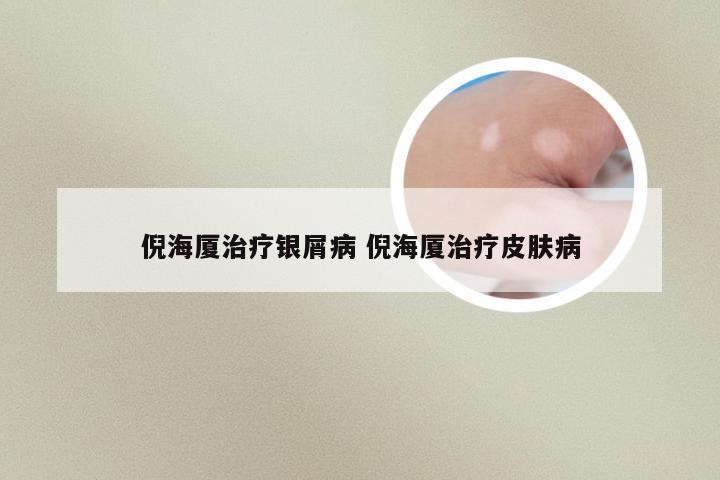 倪海厦治疗银屑病 倪海厦治疗皮肤病