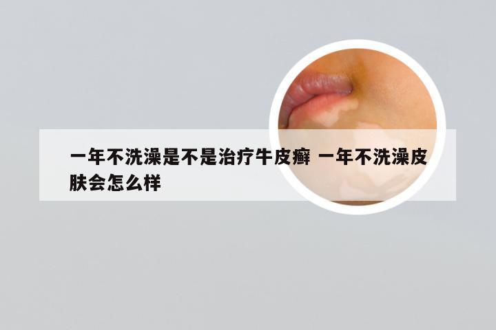 一年不洗澡是不是治疗牛皮癣 一年不洗澡皮肤会怎么样