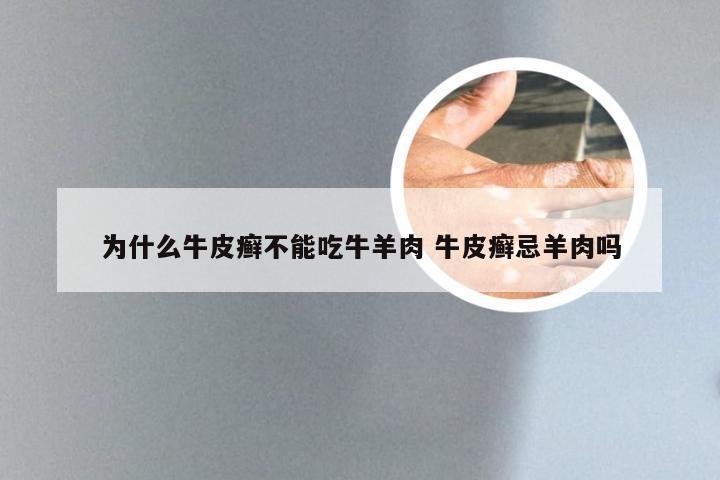 为什么牛皮癣不能吃牛羊肉 牛皮癣忌羊肉吗