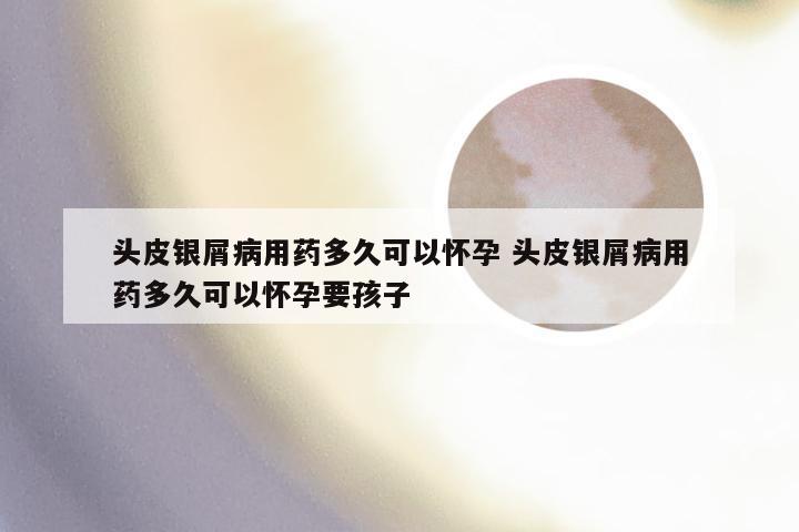 头皮银屑病用药多久可以怀孕 头皮银屑病用药多久可以怀孕要孩子