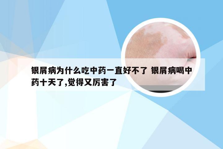 银屑病为什么吃中药一直好不了 银屑病喝中药十天了,觉得又厉害了