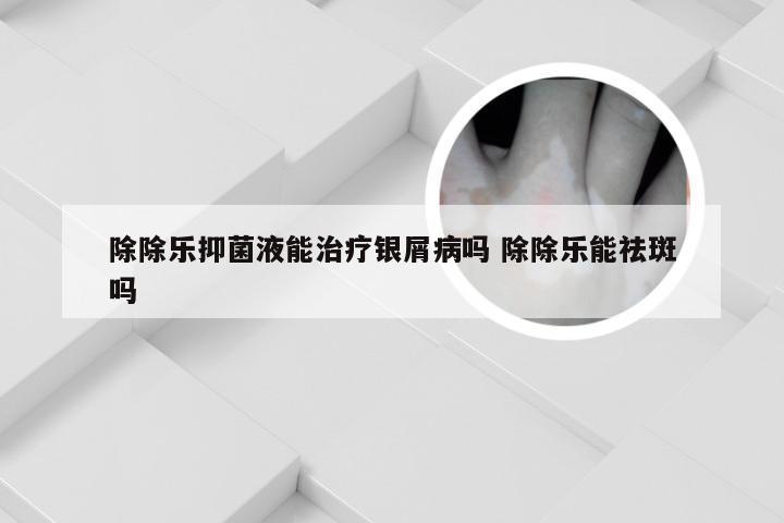 除除乐抑菌液能治疗银屑病吗 除除乐能祛斑吗