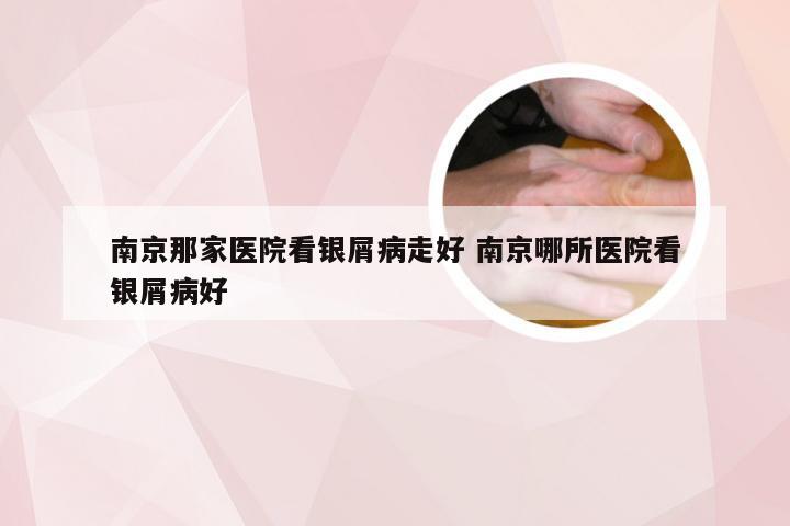 南京那家医院看银屑病走好 南京哪所医院看银屑病好