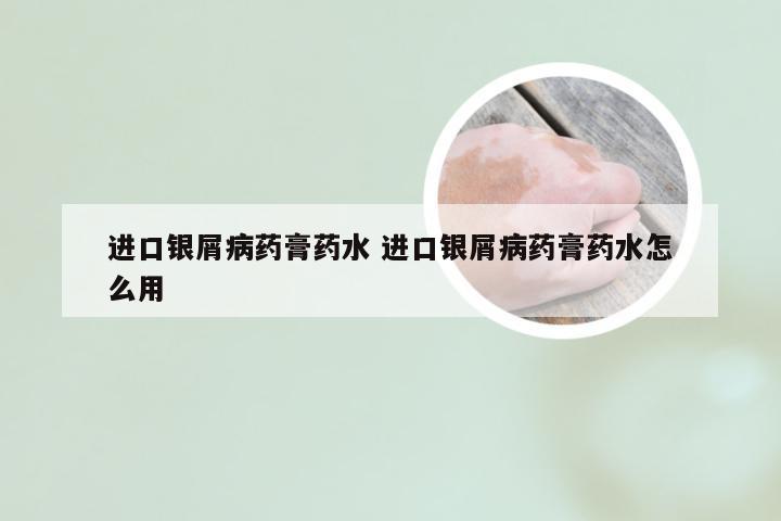 进口银屑病药膏药水 进口银屑病药膏药水怎么用