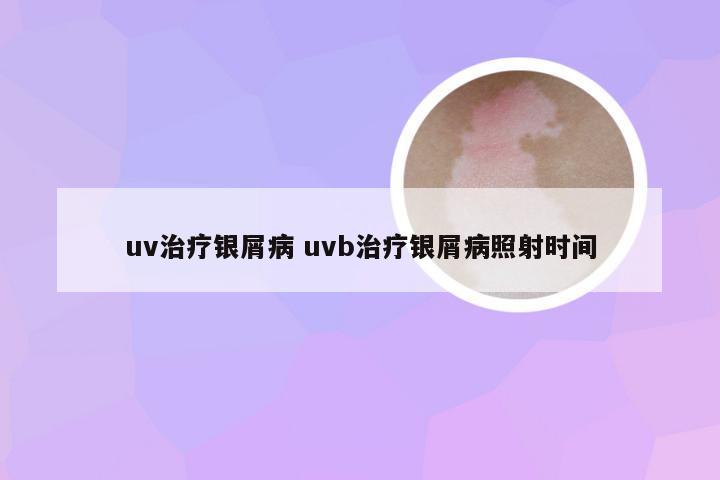 uv治疗银屑病 uvb治疗银屑病照射时间