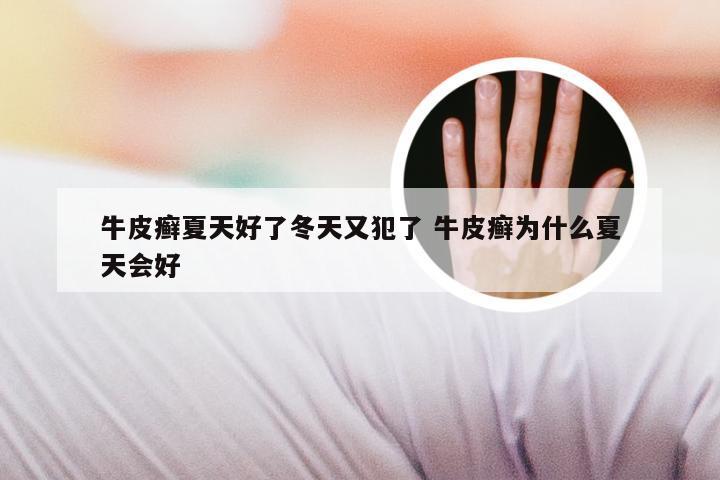 牛皮癣夏天好了冬天又犯了 牛皮癣为什么夏天会好