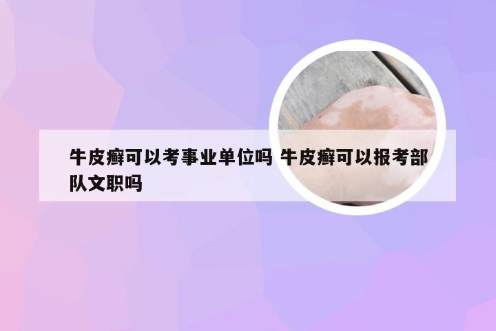 牛皮癣可以考事业单位吗 牛皮癣可以报考部队文职吗