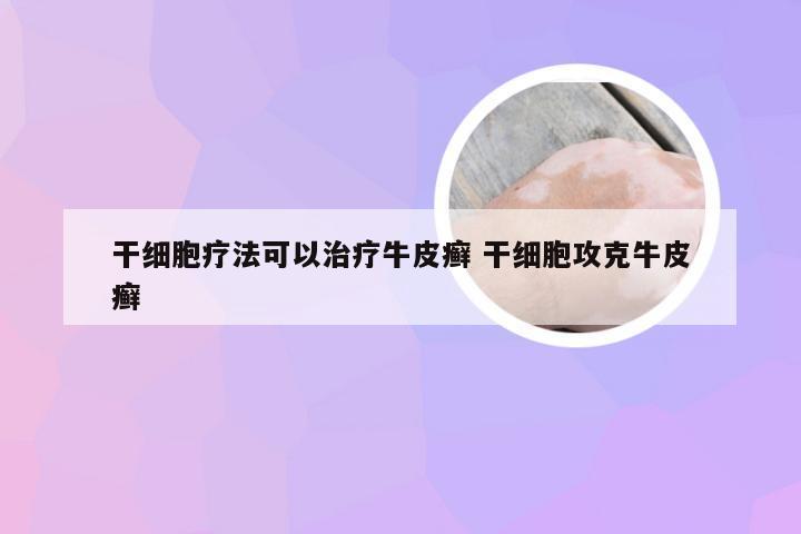 干细胞疗法可以治疗牛皮癣 干细胞攻克牛皮癣