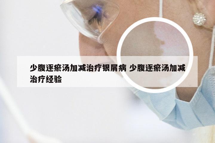少腹逐瘀汤加减治疗银屑病 少腹逐瘀汤加减治疗经验
