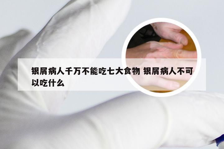 银屑病人千万不能吃七大食物 银屑病人不可以吃什么