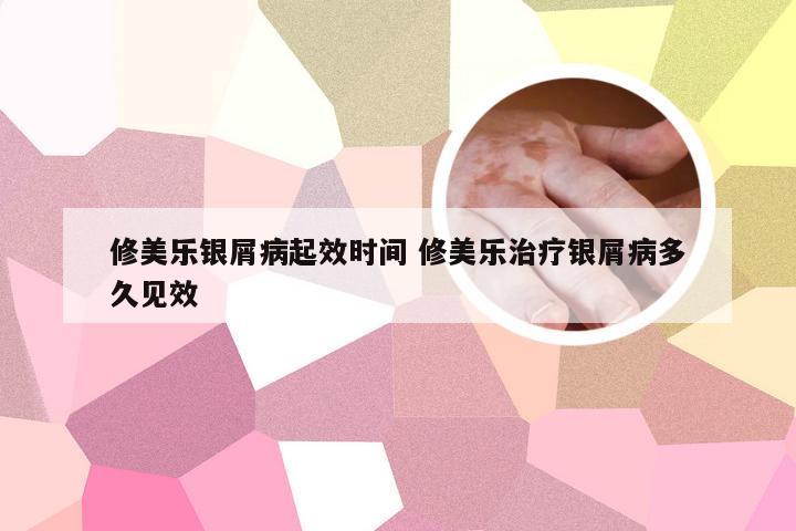 修美乐银屑病起效时间 修美乐治疗银屑病多久见效