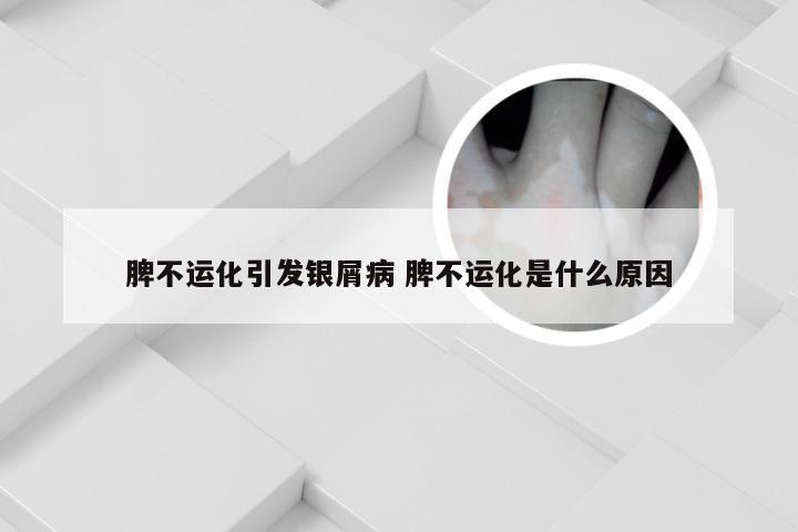 脾不运化引发银屑病 脾不运化是什么原因