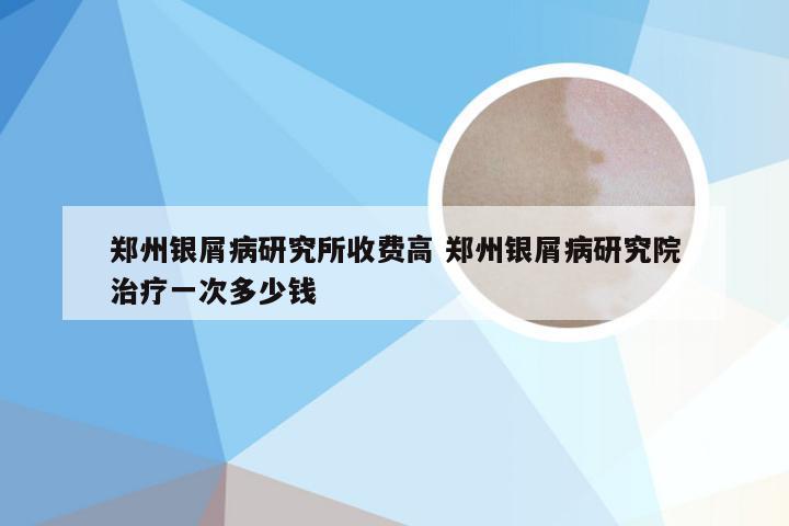郑州银屑病研究所收费高 郑州银屑病研究院治疗一次多少钱