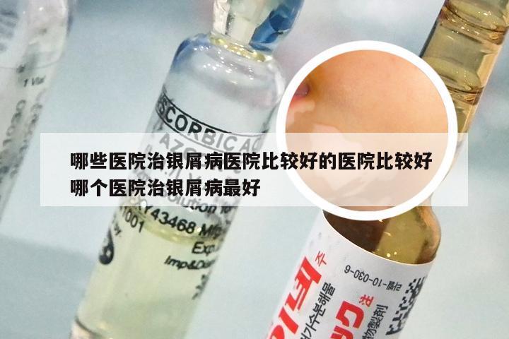 哪些医院治银屑病医院比较好的医院比较好 哪个医院治银屑病最好