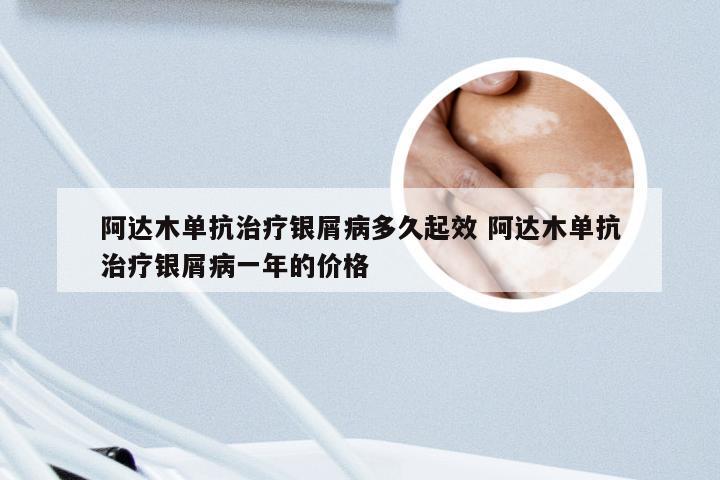 阿达木单抗治疗银屑病多久起效 阿达木单抗治疗银屑病一年的价格