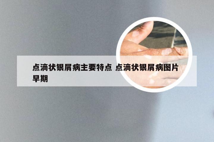点滴状银屑病主要特点 点滴状银屑病图片 早期