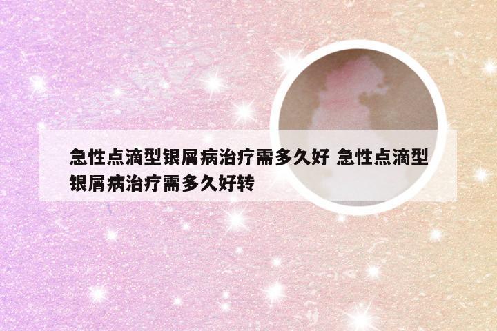急性点滴型银屑病治疗需多久好 急性点滴型银屑病治疗需多久好转