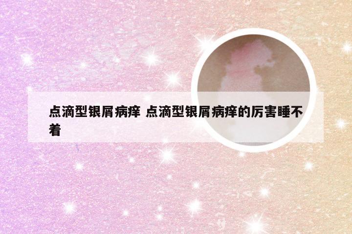 点滴型银屑病痒 点滴型银屑病痒的厉害睡不着