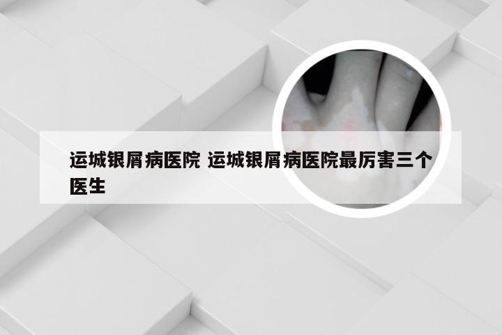 运城银屑病医院 运城银屑病医院最厉害三个医生