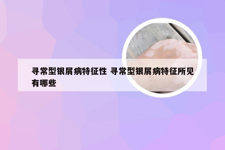寻常型银屑病特征性 寻常型银屑病特征所见有哪些