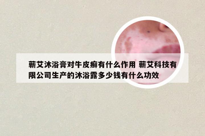 蕲艾沐浴膏对牛皮癣有什么作用 蕲艾科技有限公司生产的沐浴露多少钱有什么功效