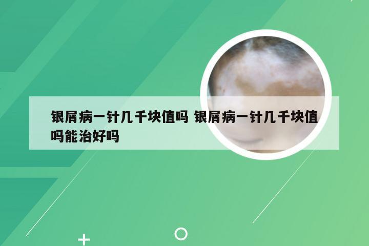 银屑病一针几千块值吗 银屑病一针几千块值吗能治好吗