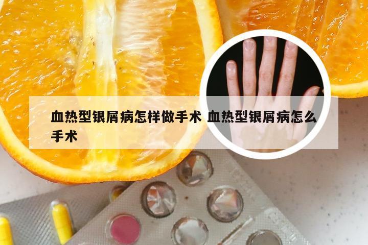 血热型银屑病怎样做手术 血热型银屑病怎么手术