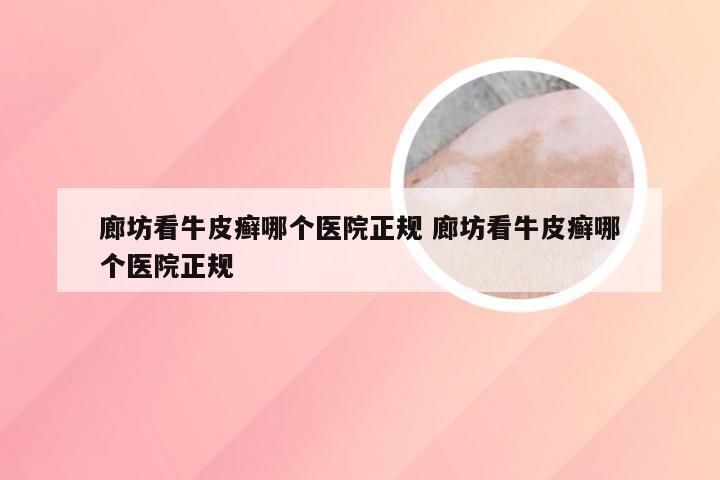 廊坊看牛皮癣哪个医院正规 廊坊看牛皮癣哪个医院正规