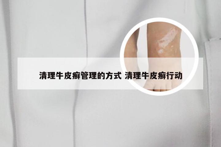 清理牛皮癣管理的方式 清理牛皮癣行动