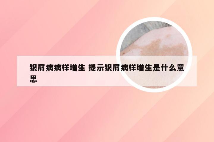 银屑病病样增生 提示银屑病样增生是什么意思