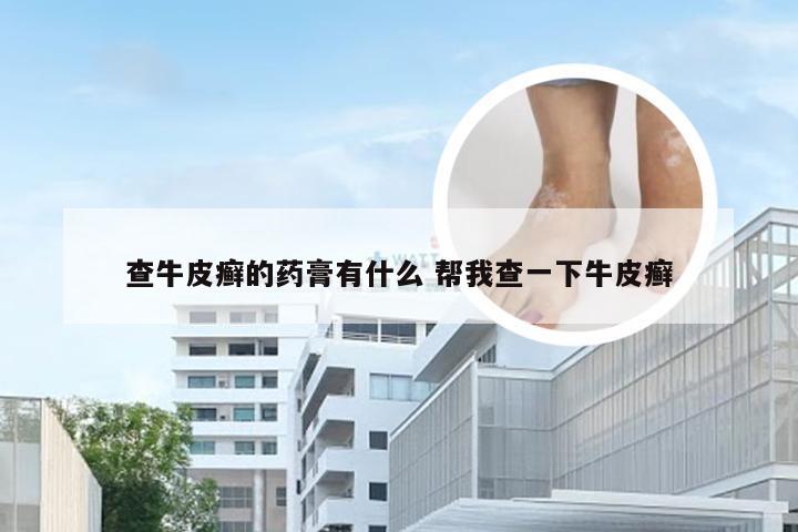 查牛皮癣的药膏有什么 帮我查一下牛皮癣