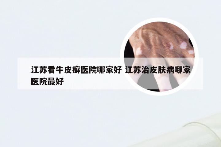 江苏看牛皮癣医院哪家好 江苏治皮肤病哪家医院最好