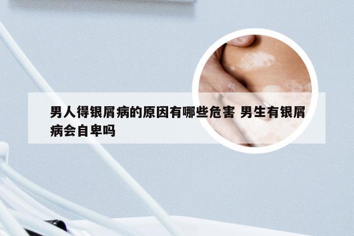 男人得银屑病的原因有哪些危害 男生有银屑病会自卑吗