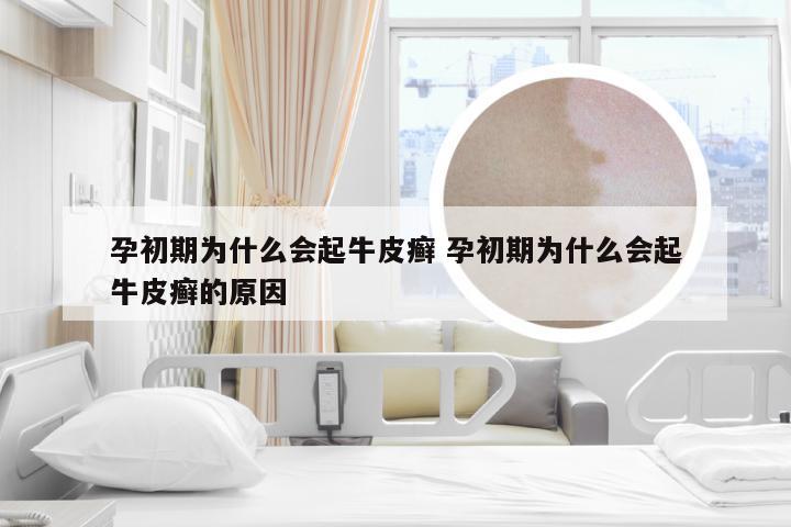 孕初期为什么会起牛皮癣 孕初期为什么会起牛皮癣的原因