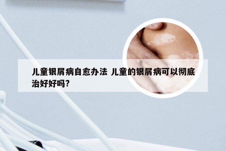 儿童银屑病自愈办法 儿童的银屑病可以彻底治好好吗?