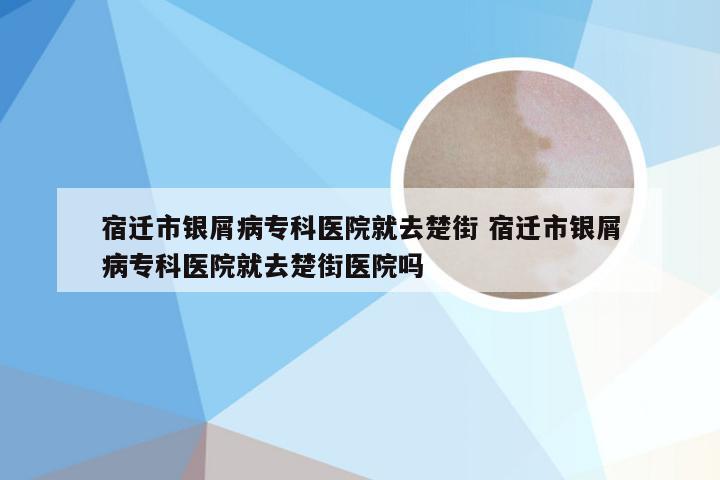 宿迁市银屑病专科医院就去楚街 宿迁市银屑病专科医院就去楚街医院吗
