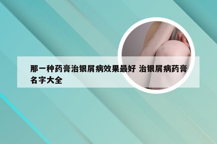 那一种药膏治银屑病效果最好 治银屑病药膏名字大全