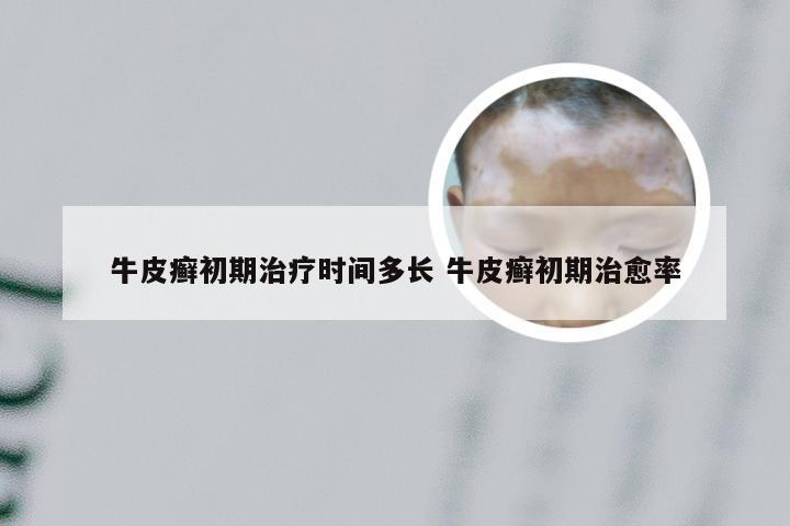 牛皮癣初期治疗时间多长 牛皮癣初期治愈率